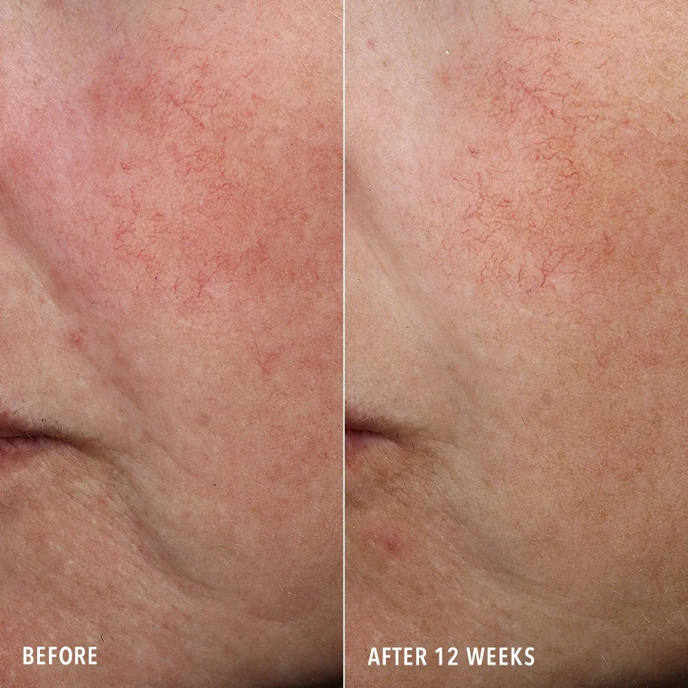 HydroPeptide Syner-C+ Multi-Action Brightening Serum